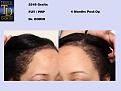 Click image for larger version

Name:	0004.jpg
Views:	213
Size:	89.3 KB
ID:	487152