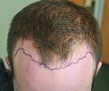 Click image for larger version

Name:	unnamed-1.jpg
Views:	363
Size:	47.6 KB
ID:	487176