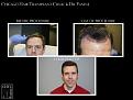 Click image for larger version

Name:	Slide2.JPG
Views:	307
Size:	80.8 KB
ID:	487215