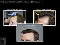 Click image for larger version

Name:	Slide3.JPG
Views:	310
Size:	87.5 KB
ID:	487216
