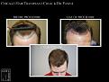 Click image for larger version

Name:	Slide5.JPG
Views:	306
Size:	85.6 KB
ID:	487218