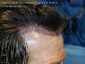 Click image for larger version

Name:	Slide10.jpg
Views:	308
Size:	82.4 KB
ID:	487223
