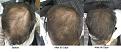 Click image for larger version

Name:	hair loss.jpg
Views:	191
Size:	97.8 KB
ID:	487431