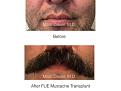 Click image for larger version

Name:	mustache fue.001.jpg
Views:	196
Size:	12.2 KB
ID:	487545