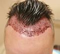 Click image for larger version

Name:	unnamed-3.jpg
Views:	194
Size:	52.0 KB
ID:	487549
