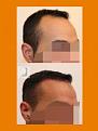 Click image for larger version

Name:	E6.jpg
Views:	352
Size:	7.3 KB
ID:	487614