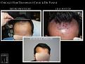 Click image for larger version

Name:	Slide2.jpg
Views:	325
Size:	67.0 KB
ID:	487627