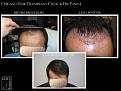 Click image for larger version

Name:	Slide5.jpg
Views:	289
Size:	67.9 KB
ID:	487630