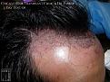 Click image for larger version

Name:	Slide17.jpg
Views:	304
Size:	95.2 KB
ID:	487642