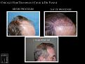 Click image for larger version

Name:	Slide3.jpg
Views:	251
Size:	63.2 KB
ID:	487782