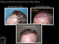 Click image for larger version

Name:	Slide4.jpg
Views:	251
Size:	61.7 KB
ID:	487783