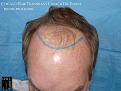 Click image for larger version

Name:	Slide6.jpg
Views:	246
Size:	68.6 KB
ID:	487785