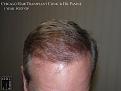 Click image for larger version

Name:	Slide16.jpg
Views:	241
Size:	61.0 KB
ID:	487795