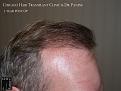 Click image for larger version

Name:	Slide18.jpg
Views:	254
Size:	77.2 KB
ID:	487797