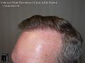 Click image for larger version

Name:	Slide20.jpg
Views:	324
Size:	68.9 KB
ID:	487799