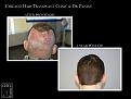 Click image for larger version

Name:	Slide6.JPG
Views:	352
Size:	80.6 KB
ID:	487977