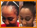 Click image for larger version

Name:	Gio Macatti My World Hair Transplant Center 1000.jpg
Views:	322
Size:	47.2 KB
ID:	488332
