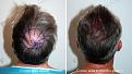 Click image for larger version

Name:	AR2.jpg
Views:	281
Size:	97.1 KB
ID:	488383