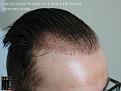 Click image for larger version

Name:	Slide10.jpg
Views:	206
Size:	57.7 KB
ID:	488521