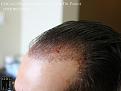 Click image for larger version

Name:	Slide11.jpg
Views:	202
Size:	57.6 KB
ID:	488522