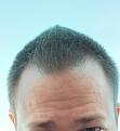 Click image for larger version

Name:	IMG_20181125_155820.jpg
Views:	416
Size:	77.2 KB
ID:	489781