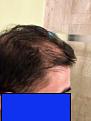 Click image for larger version

Name:	IMG_6269.jpg
Views:	165
Size:	7.8 KB
ID:	489822