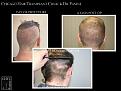 Click image for larger version

Name:	Slide5.JPG
Views:	222
Size:	97.3 KB
ID:	490112
