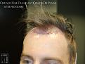 Click image for larger version

Name:	Slide13.jpg
Views:	208
Size:	59.7 KB
ID:	490120