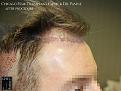 Click image for larger version

Name:	Slide14.jpg
Views:	199
Size:	74.8 KB
ID:	490121