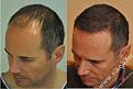 Click image for larger version

Name:	unnamed-5.jpg
Views:	422
Size:	35.3 KB
ID:	490211