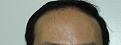 Click image for larger version

Name:	IMG_2920-cropped.jpg
Views:	228
Size:	66.7 KB
ID:	490221