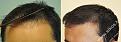 Click image for larger version

Name:	unnamed-4.jpg
Views:	234
Size:	19.7 KB
ID:	490575