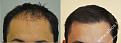 Click image for larger version

Name:	unnamed-6.jpg
Views:	243
Size:	95.5 KB
ID:	490577