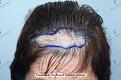 Click image for larger version

Name:	ZM7.jpg
Views:	244
Size:	95.0 KB
ID:	490867