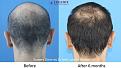 Click image for larger version

Name:	Slide5.thumb.JPG.8439159952ca10fbeb64f8b2232de2cb.jpg
Views:	292
Size:	76.1 KB
ID:	490927