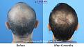 Click image for larger version

Name:	Slide6.thumb.JPG.c7155cefd838a67b087bccef365012c3.jpg
Views:	298
Size:	68.9 KB
ID:	490928