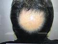 Click image for larger version

Name:	IMG_2981.jpg
Views:	227
Size:	83.7 KB
ID:	490935