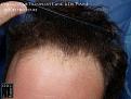 Click image for larger version

Name:	Slide5.jpg
Views:	200
Size:	86.3 KB
ID:	490960