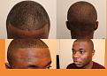 Click image for larger version

Name:	results before  after a.jpg
Views:	237
Size:	91.8 KB
ID:	491061