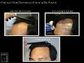 Click image for larger version

Name:	Slide3.JPG
Views:	182
Size:	94.2 KB
ID:	491234