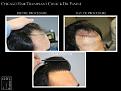Click image for larger version

Name:	Slide4.jpg
Views:	180
Size:	61.6 KB
ID:	491235