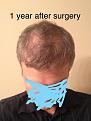 Click image for larger version

Name:	IMG_4991_LI.jpg
Views:	382
Size:	90.6 KB
ID:	491331