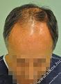Click image for larger version

Name:	unnamed-3.jpg
Views:	264
Size:	17.2 KB
ID:	491403