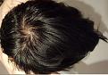 Click image for larger version

Name:	bed hair whorl.jpg
Views:	179
Size:	96.1 KB
ID:	491613
