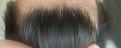 Click image for larger version

Name:	hairline 1.jpg
Views:	185
Size:	96.6 KB
ID:	491614