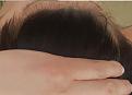 Click image for larger version

Name:	hairline 3.jpg
Views:	176
Size:	83.5 KB
ID:	491616