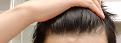 Click image for larger version

Name:	hairline front.jpg
Views:	174
Size:	97.3 KB
ID:	491617