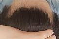 Click image for larger version

Name:	Post wash  towel dry (still wet) hairline.jpg
Views:	181
Size:	85.4 KB
ID:	491619