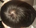 Click image for larger version

Name:	whorl light 1.jpg
Views:	174
Size:	91.6 KB
ID:	491622