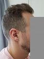 Click image for larger version

Name:	right side of hair copy.jpg
Views:	528
Size:	7.3 KB
ID:	491804